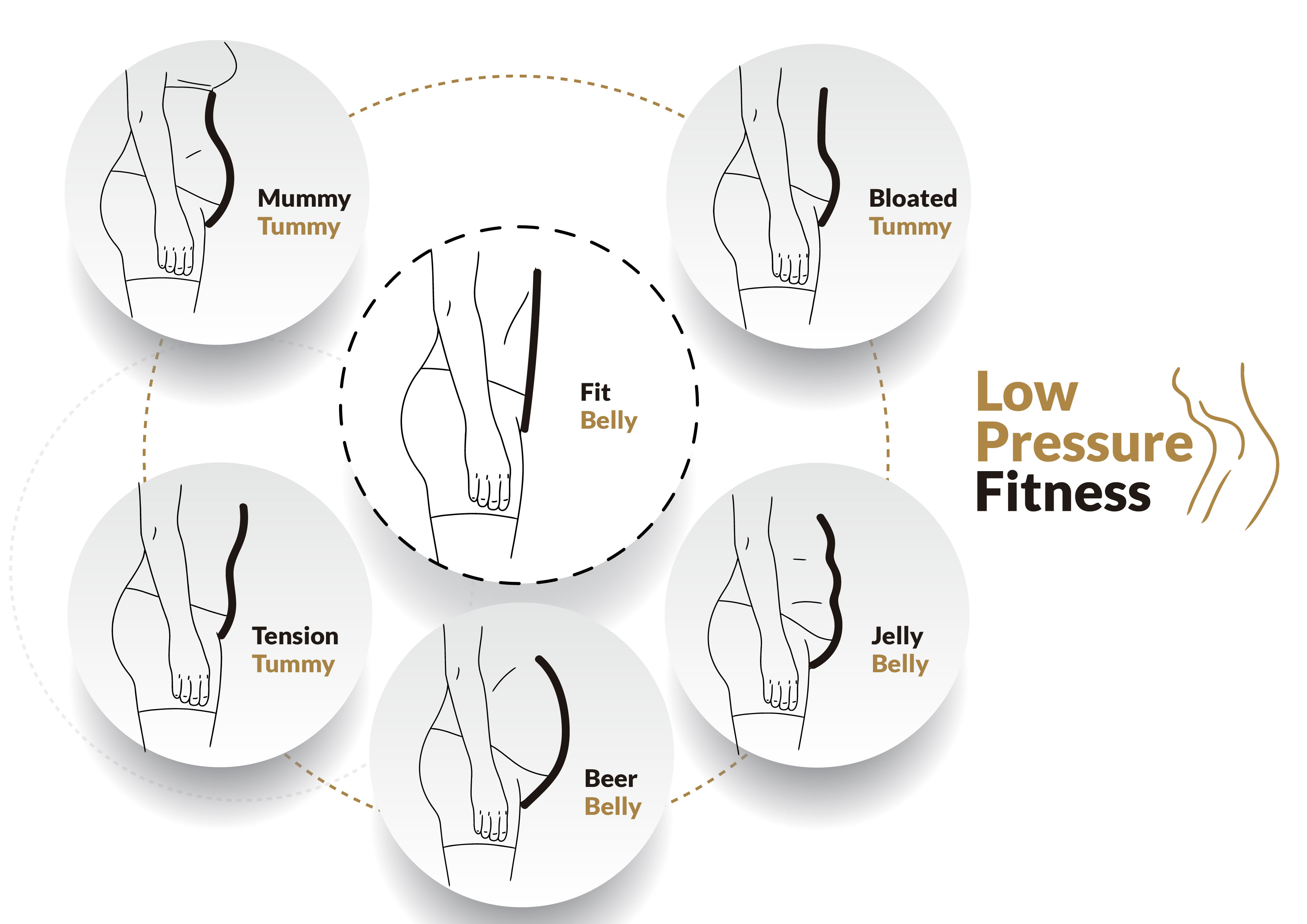 tipos-abdomen-LPF tipos-abdomen-LPF